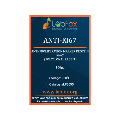 Anti-Ki67 (polyclonal rabbit antibody