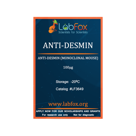Anti-desmin (monoclonal mouse antibody)